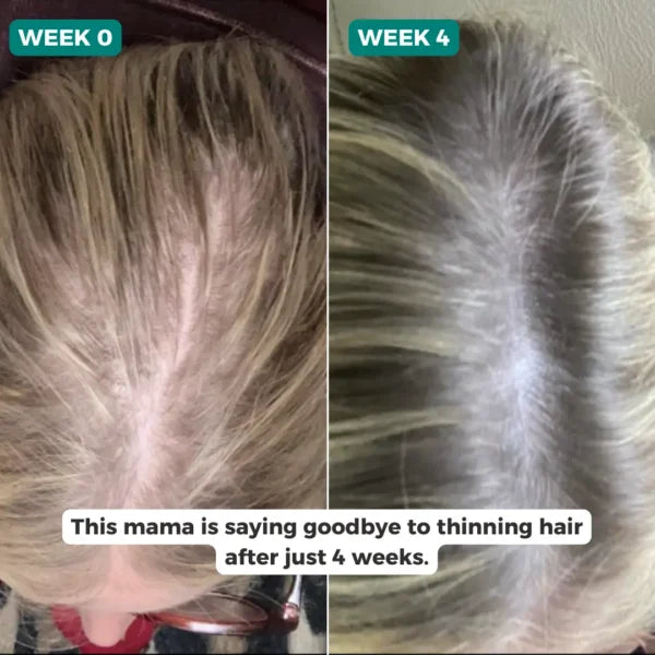 Herbal Hair Growth Spray