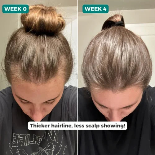 Herbal Hair Growth Spray