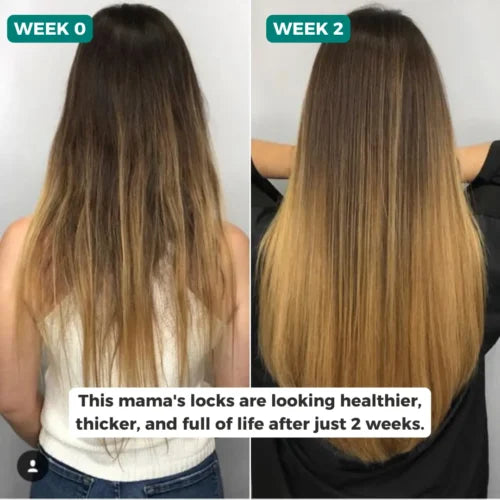 Herbal Hair Growth Spray